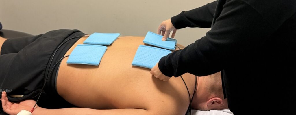 Physiotherapist applying blue electrode pads for electrical stimulation therapy on patient's lower back at Mt. Lehman Physiotherapy Clinic in Abbotsford, BC